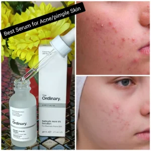 THE ORDINARY SALICYLIC ACID 2% SOLUTION 30ML