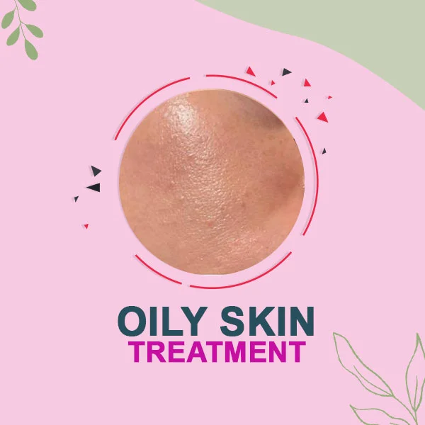 Oily Skin