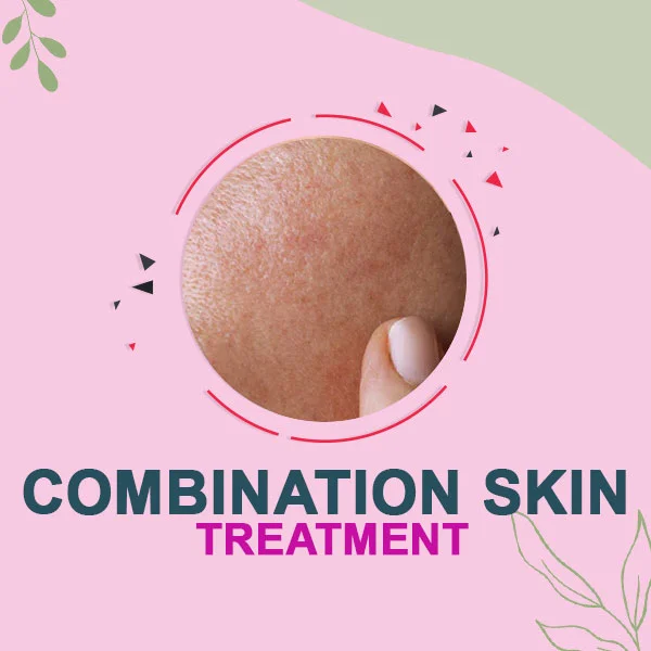 Combination Skin